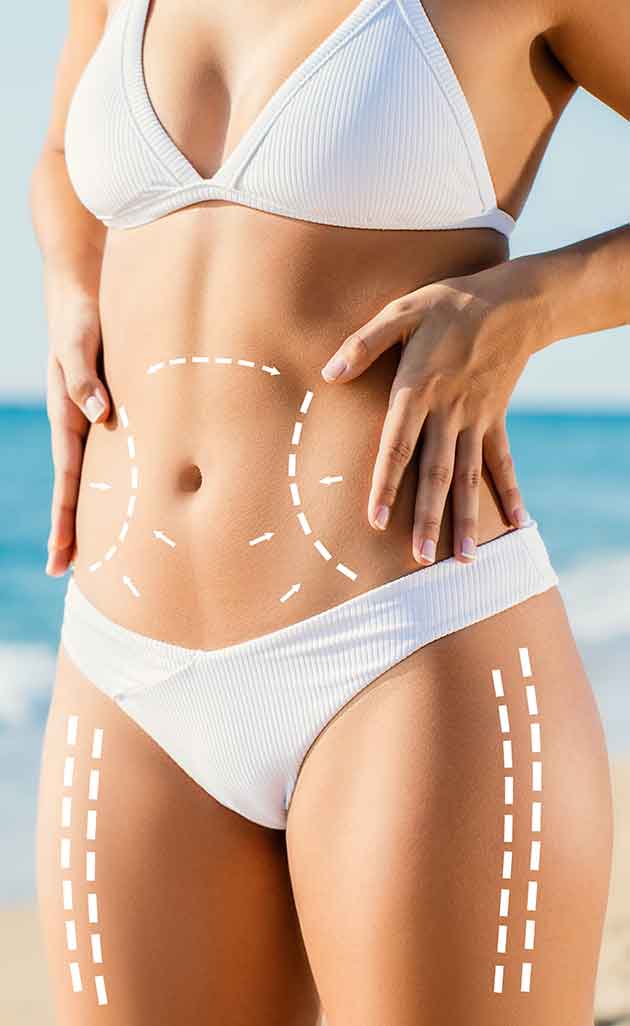 Liposuction Treatment Specialist Near Me in New Bern, NC