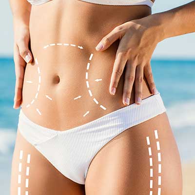 Liposuction Treatment Specialist Near Me in New Bern, NC