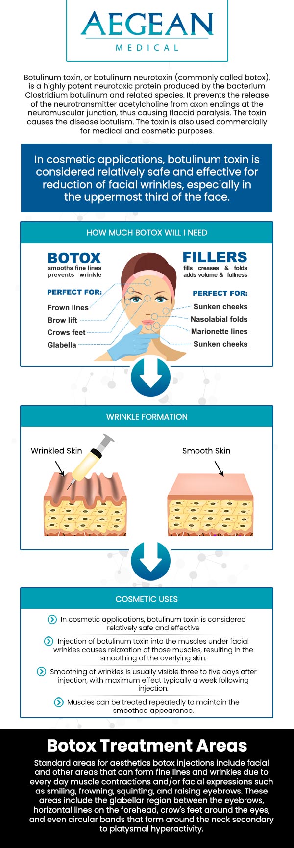 While the lines of age can be a cause for pride, they can also be a cause for self-consciousness! If you find that fine lines and wrinkles are more of an unwanted distraction than anything else, Botox injections are a safe and subtle way to address that concern. We would be happy to administer this treatment to you at Aegean Medical! Contact us for more information or schedule an appointment online. We are conveniently located at 2111 Neuse Blvd Suite J, New Bern, NC 28560.