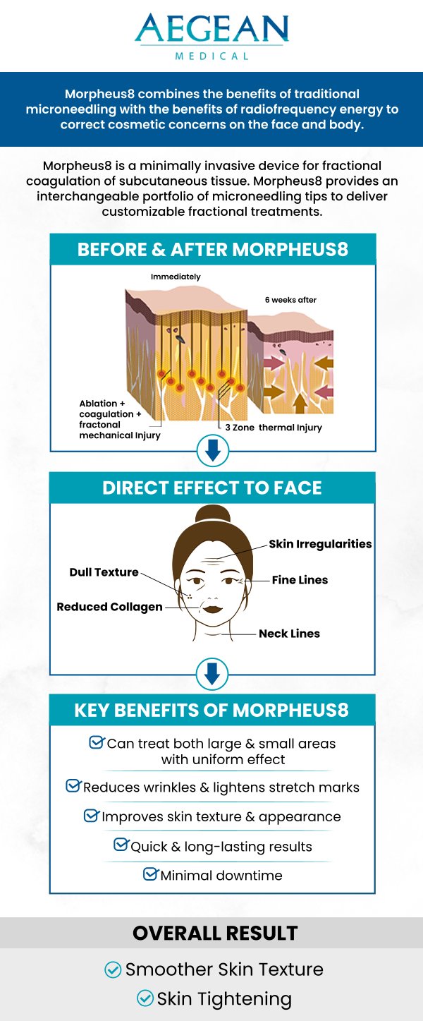 Morpheus8 treatment provides a triple threat attack on various aging signs like skin laxity, wrinkles, fine lines, stretch marks, and several others. Aegean Medical is proud to provide Morpheus8 treatment! Contact us for more information or schedule an appointment online. We are conveniently located at 2111 Neuse Blvd Suite J, New Bern, NC 28560.