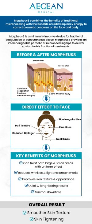 Morpheus8 treatment provides a triple threat attack on various aging signs like skin laxity, wrinkles, fine lines, stretch marks, and several others. Aegean Medical is proud to provide Morpheus8 treatment! Contact us for more information or schedule an appointment online. We are conveniently located at 2111 Neuse Blvd Suite J, New Bern, NC 28560.