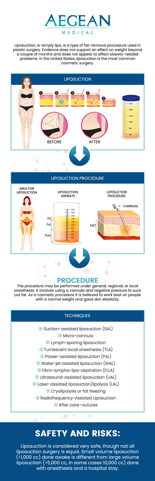 Liposuction is a procedure that involves suctioning fat and other lipids from a person’s body in order to achieve weight loss. If you are interested in body contouring, come to Aegean Medical today! Dr. Angelo Tellis MD can answer all of your questions about liposuction and help you determine if the procedure is right for you or not. Contact us for more information or schedule an appointment online. We are conveniently located at 2111 Neuse Blvd Suite J, New Bern, NC 28560.