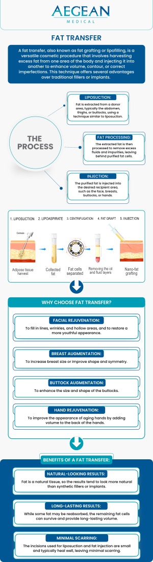 If you are interested in a natural, safer way to enhance the shape of your breasts or give your breasts a moderate increase in size, then this is the right procedure for you. Dr. Angelo Tellis MD at Aegean Medical offers fat transfer treatment to naturally enhance the buttocks and breasts. Please contact us now for more information or book an appointment online. We are conveniently located at 2111 Neuse Blvd, Suite J, New Bern, NC 28560. If you are interested in a natural, safer way to enhance the shape of your breasts or give your breasts a moderate increase in size, then this is the right procedure for you. Dr. Angelo Tellis MD at Aegean Medical offers fat transfer treatment to naturally enhance the buttocks and breasts. Please contact us now for more information or book an appointment online. We are conveniently located at 2111 Neuse Blvd, Suite J, New Bern, NC 28560.