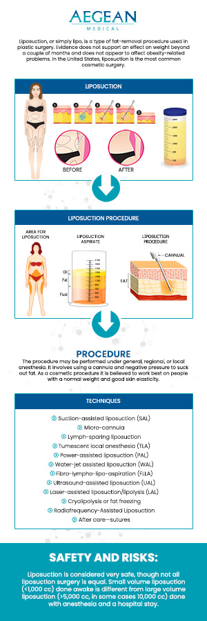 At Aegean Medical in New Bern, NC, Dr. Angelo Tellis MD specializes in thigh liposuction, offering tailored treatments to achieve your desired contours. With a focus on patient safety and satisfaction, Dr. Tellis combines advanced techniques with personalized care. Visit us today to explore how thigh liposuction can enhance your confidence and appearance. Please contact us now for more information or book an appointment online. We are conveniently located at 2111 Neuse Blvd, Suite J, New Bern, NC 28560. At Aegean Medical in New Bern, NC, Dr. Angelo Tellis MD specializes in thigh liposuction, offering tailored treatments to achieve your desired contours. With a focus on patient safety and satisfaction, Dr. Tellis combines advanced techniques with personalized care. Visit us today to explore how thigh liposuction can enhance your confidence and appearance. Please contact us now for more information or book an appointment online. We are conveniently located at 2111 Neuse Blvd, Suite J, New Bern, NC 28560.