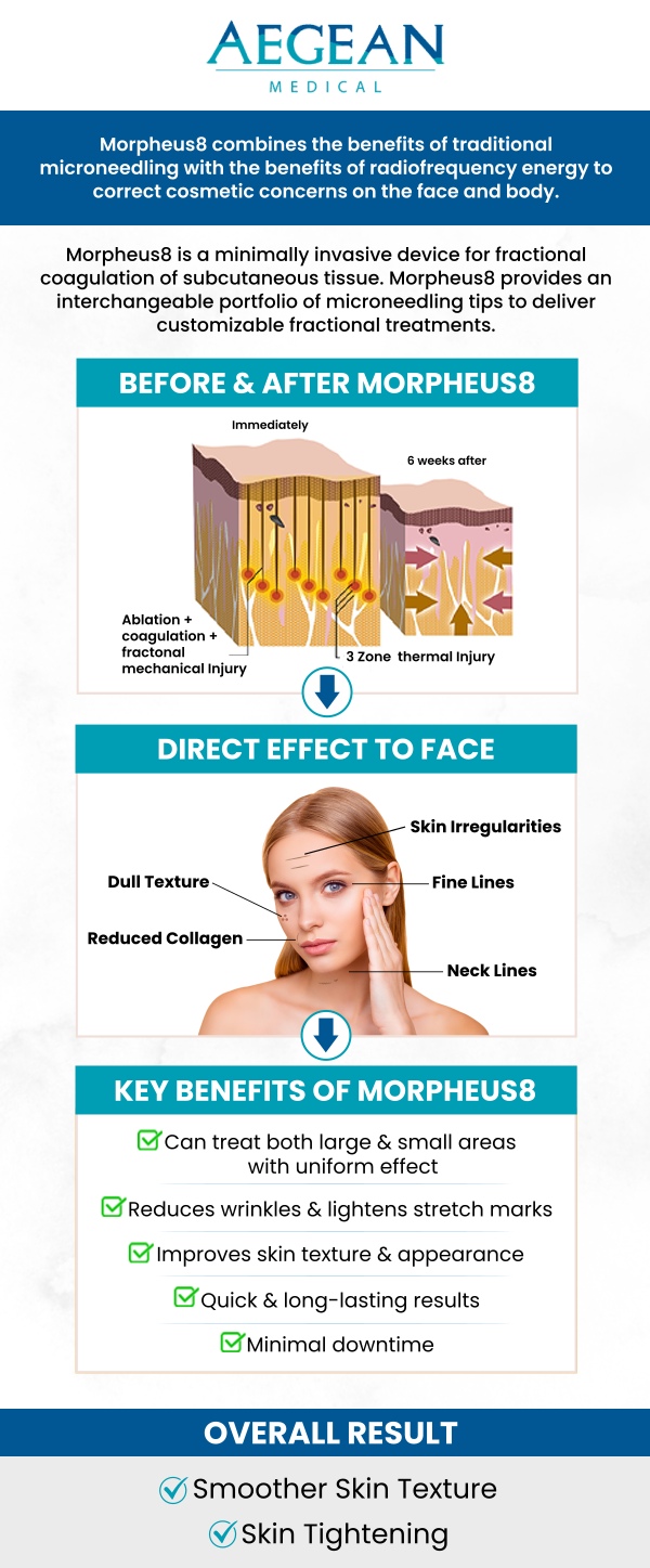 Morpheus is a modern skin-resurfacing technology. Ideal for improving the appearance of stretch marks, wrinkles, enlarged pores, and acne scars. It’s a non-surgically treatment and produces transformative results. Trust the experienced specialist Dr. Angelo A. Tellis MD at Aegean Medical. Contact us or request an appointment online for more information. We are conveniently located at 2111 Neuse Blvd Suite J, New Bern, NC 28560. Morpheus is a modern skin-resurfacing technology. Ideal for improving the appearance of stretch marks, wrinkles, enlarged pores, and acne scars. It’s a non-surgically treatment and produces transformative results. Trust the experienced specialist Dr. Angelo A. Tellis MD at Aegean Medical. Contact us or request an appointment online for more information. We are conveniently located at 2111 Neuse Blvd Suite J, New Bern, NC 28560.