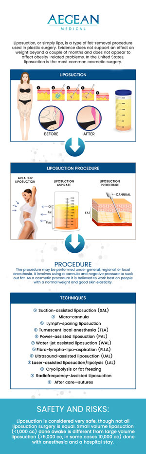 Liposuction is a popular cosmetic procedure designed to remove stubborn fat and sculpt the body. At Aegean Medical, Dr. Angelo A. Tellis, MD, provides advanced liposuction procedures tailored to your body goals. Whether you're looking to target specific fat areas or enhance your body contours, we are committed to helping you achieve the results you desire. Contact us for more information or book an appointment online. We are conveniently located at 2111 Neuse Blvd, Suite J, New Bern, NC 28560.